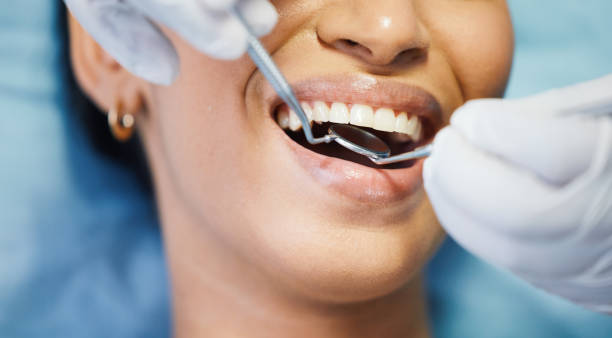 Best Emergency Dental Services for Seniors in Granville, OH